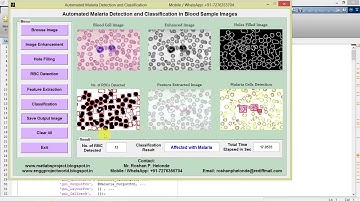 Malaria Parasite Detection and Classification in Blood Sample Images Matlab Project Code