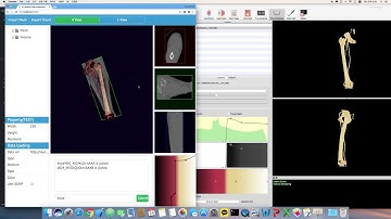 Web Medical App - Volume Rendering