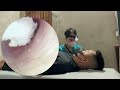 耳掃除 | ASMR EARWAX REMOVAL |*03*