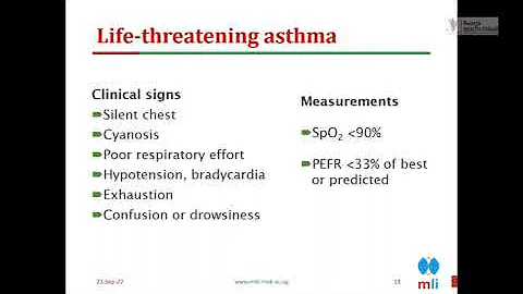Management of asthma exacerbations in children by ...