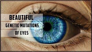 Beautiful genetic mutations of eyes