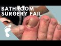 MEGA INGROWN REMOVAL