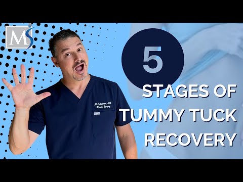 Tummy Tuck Recovery