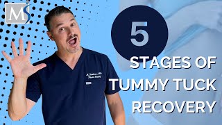 Tummy Tuck Recovery  5 stages