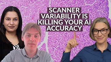 How much does scanner variability affect your AI algorithm