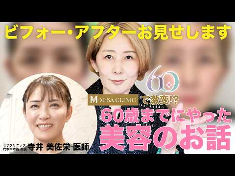 【美容・コラボ】ひうらさとるが60歳までにやった美容のお話！ビフォーアフター写真も！【ミサクリニックとのコラボ動画】