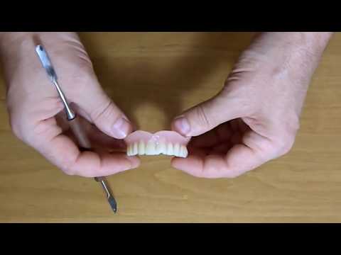 Video: Prednosti, Nedostatci, Troškovi I Njega Zuba (djelomična Proteza)