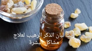 زيت لبان الذكر الرهيب للقضاء على التجاعيد وندبات الوجه