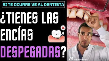 ¿Por qué se me despegan las encías de los dientes?