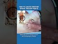 How to Locate Erector Spinae Trigger Points