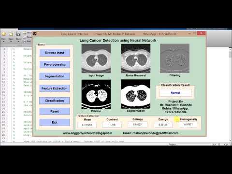 Lung Cancer Detection using neural network Image processing project | Lung Cancer Prediction
