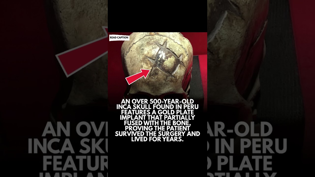 This Skull Proves Ancient Surgeons Were Geniuses...๐คฏ