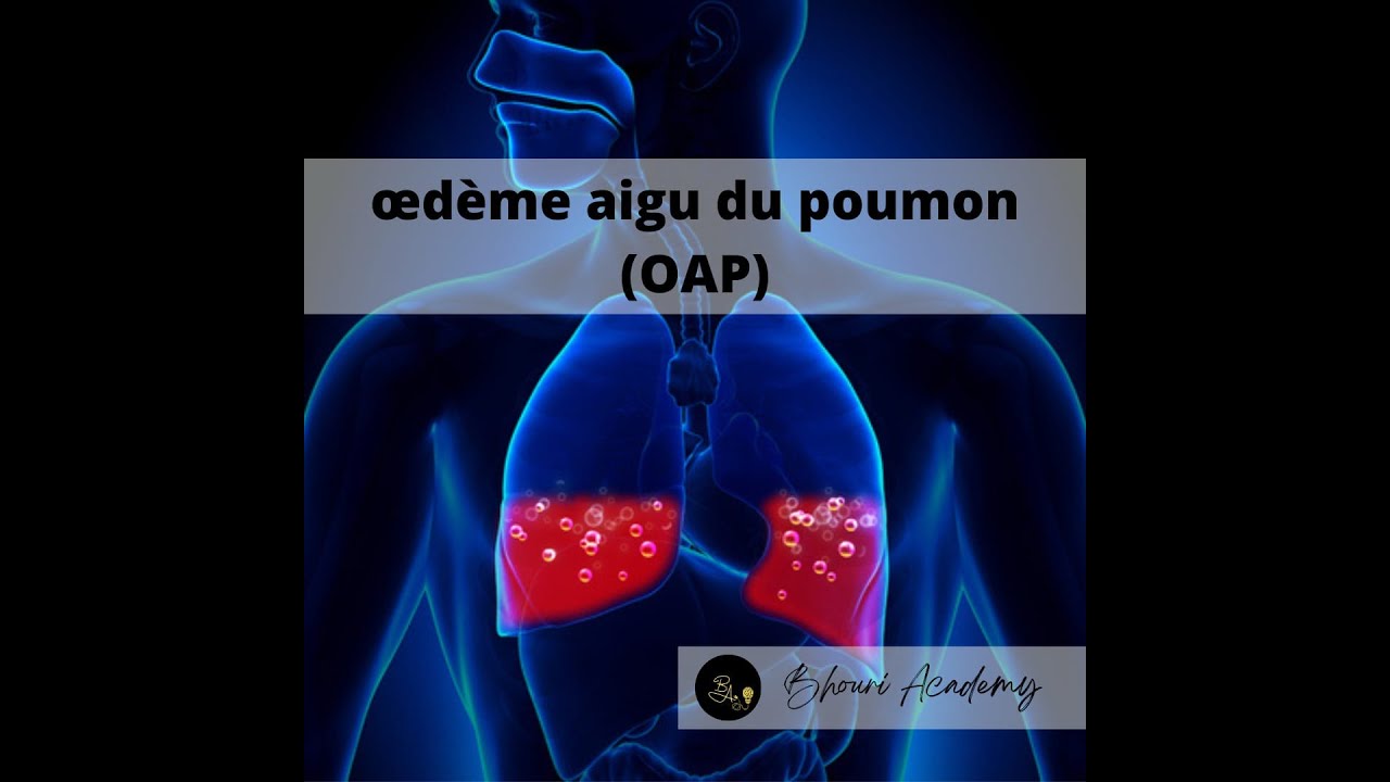 Préparation EVC de la PAE _ épisode14: Extrait du cours Oap : Facteurs ...