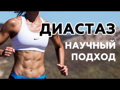 Диастаз прямых мышц живота / Тренировка, эффективные упражнения при диастазе