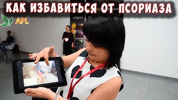 🌟 APL GO ▶️ КАК ИЗБАВИТЬСЯ ОТ ПСОРИАЗА! С помощью леденцов ALT, MLS. Отзывы о продукте компании APL