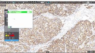 3DHISTECH - Her2stain quantification using PatternQuant and MembraneQuant screenshot 2