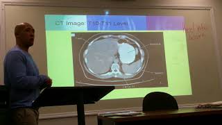 Rad 150 Lecture 12: Video 1 of 4