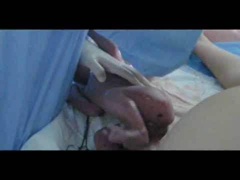 赤ちゃん誕生の瞬間 出産に立ち会った My Wife S Childbirth Youtube