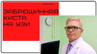 Кистозное образование забрюшинного пространства на УЗИ.