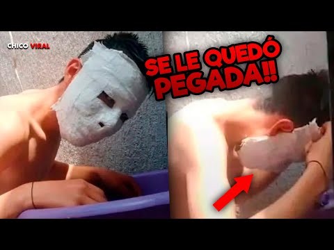 JOVEN HACE MASCARA DE YESO Y SE LE QUEDA PEGADA AL ROSTRO