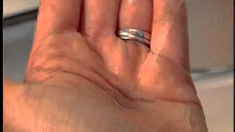 Caring For Your Contact Lenses