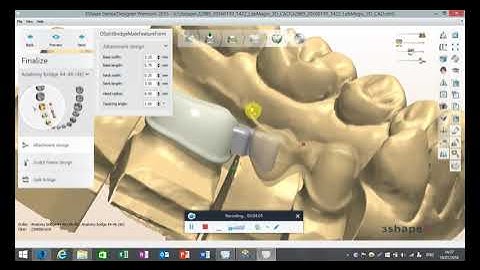 How to split a Zirconia Frame Bridge in 3Shape