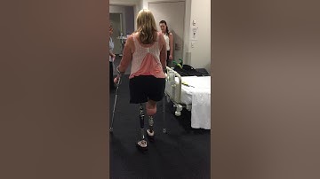 Below knee and above knee amputation and osseointegration | Dr Munjed Al Muderis Patient