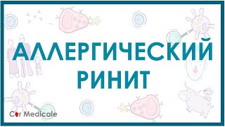 Аллергический ринит - причины, симптомы, лечение