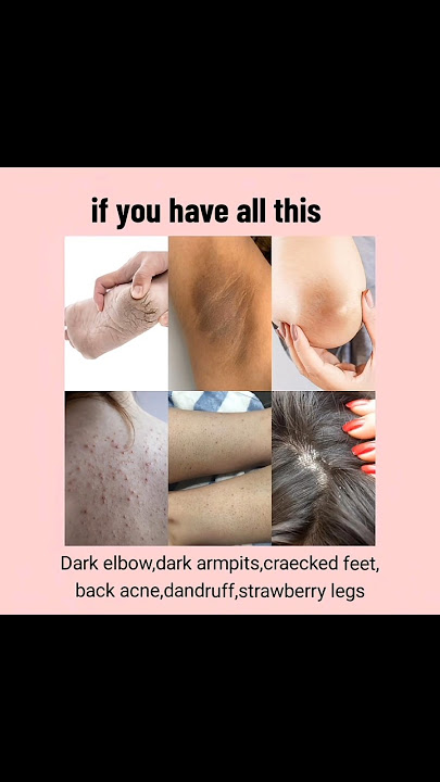 The Ordinary Fix Your Skin Problems | No More Tired of Skin Issues! #shorts #skinproblems #selfcare
