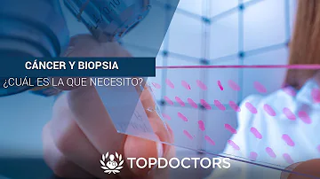 ¿Puede una biopsia no ser cancerosa?