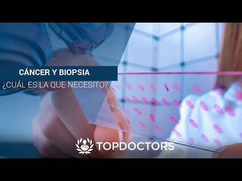 Cáncer y Biopsia ¿Cuál es la que necesito?