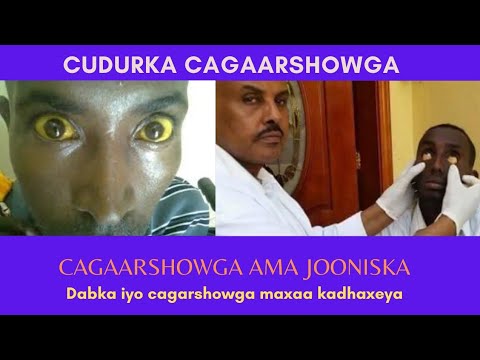 Cagaarshow | cagarshowga iyo isgubida?! | sidee looga hortagaa cagarshowga.