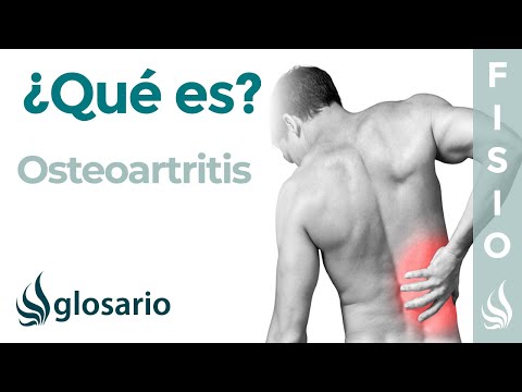 Vídeo: Osteoartritis De La Mano: Síntomas, Tratamientos Y Pronóstico