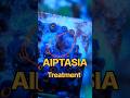 Aiptasia on my Zoas! How to Treat and Kill Aiptasia! #reeftank #saltwatertank #zoanthids #zoas