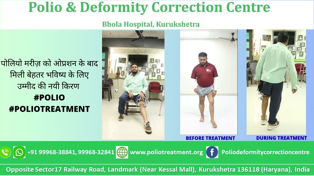 Patient's dream came true #trending#youtubeshorts#shorts#viralvidio#polio#poliotreatment#explore