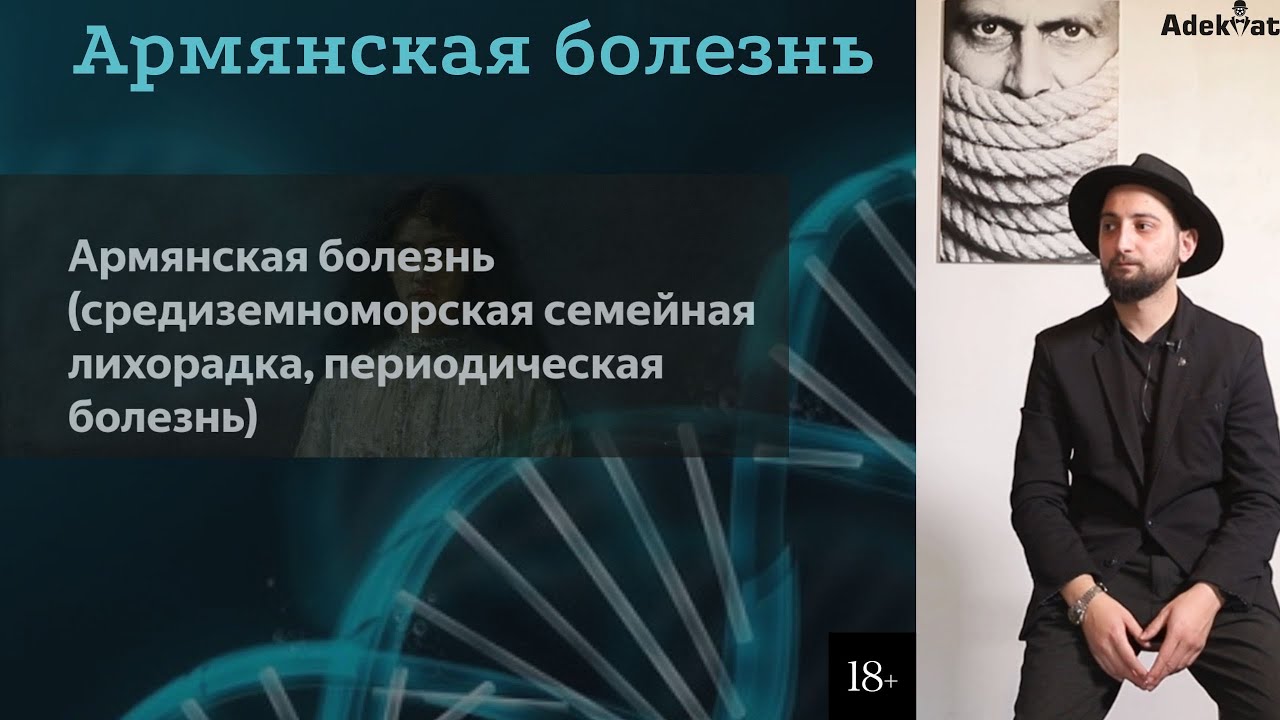 Армянская болезнь. #армения #ереван #армяне - YouTube