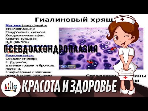 Псевдоахондроплазия