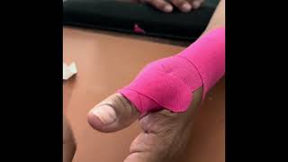 USC Capstone: Kinesiology Tape for De Quervain’s Tenosynovitis