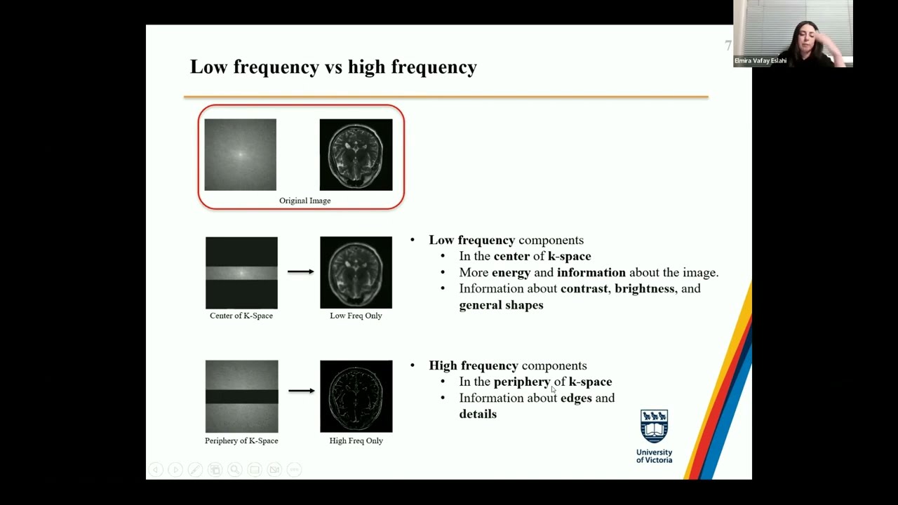 Magnetic Resonance Image Reconstruction using Inception based Convolutional Neural Network
