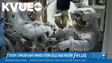 Spaceflight makes stem cells age quicker, study shows