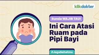 Cara Atasi Ruam pada Pipi Bayi yang WAJIB Diketahui Bunda