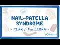 Nail-Patella syndrome (Year of the Zebra)