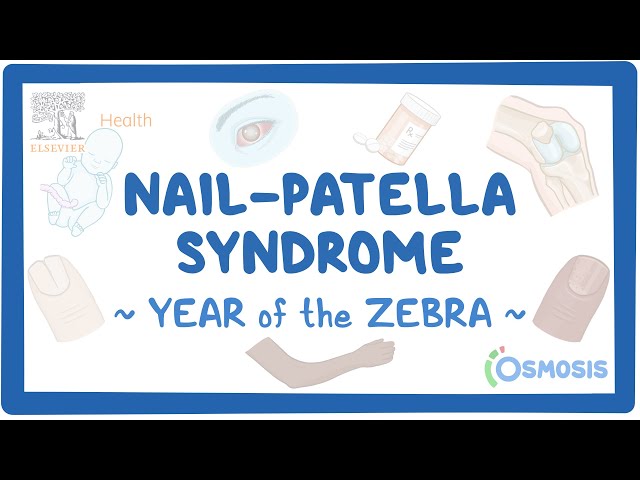 Nail patella syndrome