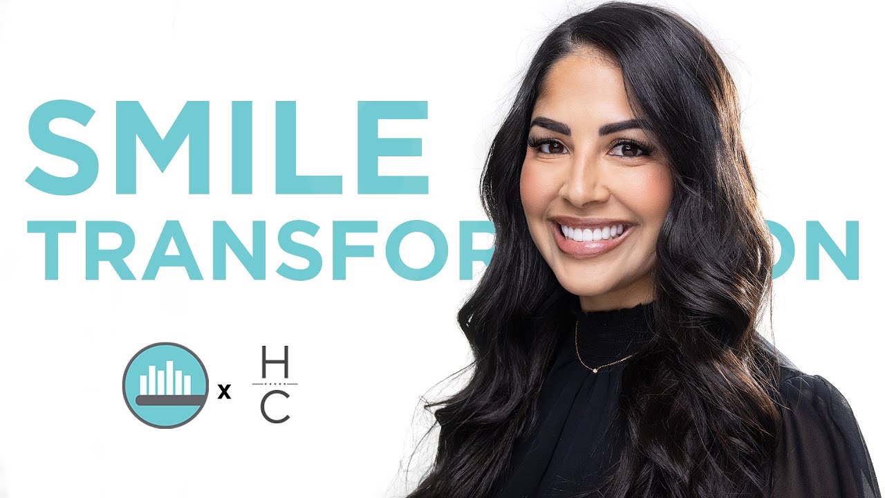 Maggie Smile Transformation