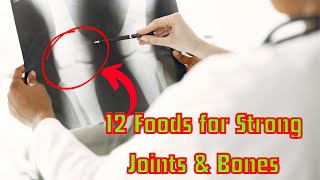 12 Foods that can enhance your Joints and Bones to become strong