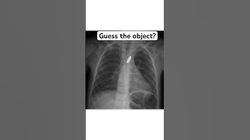 Guess the foreign object in Xray? Wait for answer #xray #xraytech #radiographer #radiology #dha #doh