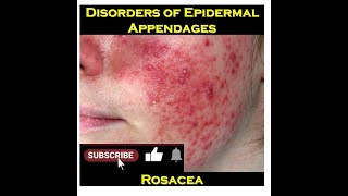 4c - Rosacea screenshot 5