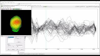 EMSE   Imaginary Coherency and Hilbert Transform