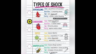 Types of Shock Explained in 60 Seconds | USMLE, NCLEX & Medical Students