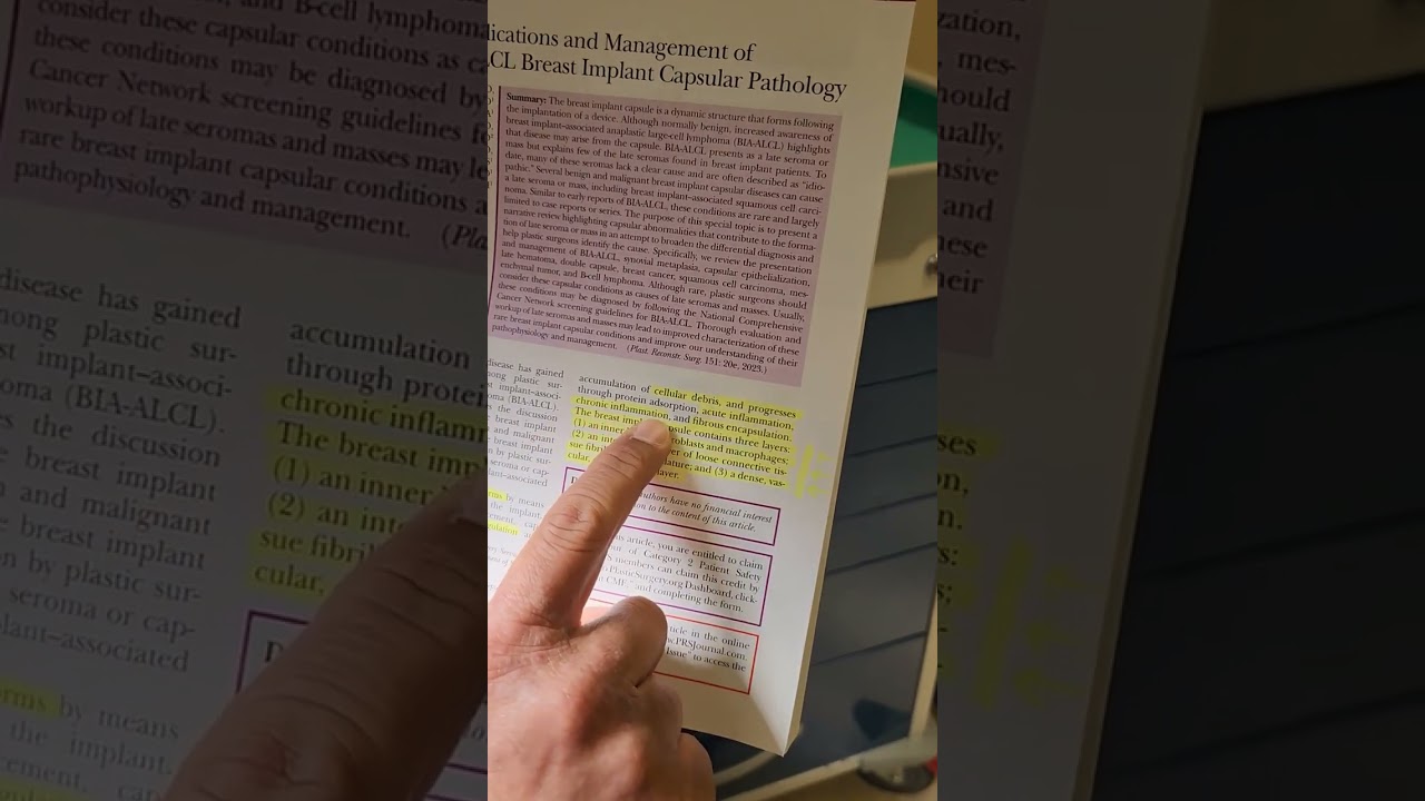 Understanding Breast Implant Capsules: Layers and Implications